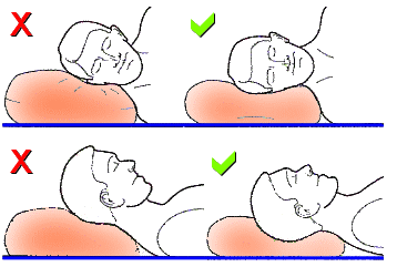 neck strain after sleeping