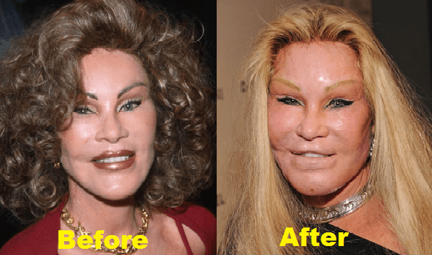 Jocelyn Wildenstein
