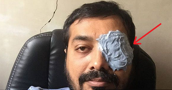 Anurag Kashyap Trolled Media Badly With Fake Accident News & Came Up With Something Great RVCJ Media