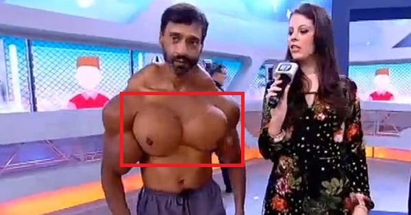 This Man Is The Living Proof Why You Should Not Inject Fake Muscles RVCJ Media