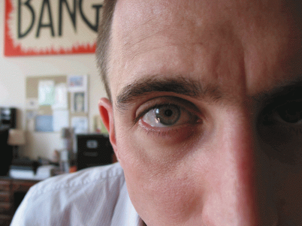 gulf-breeze-twtiching-eyes