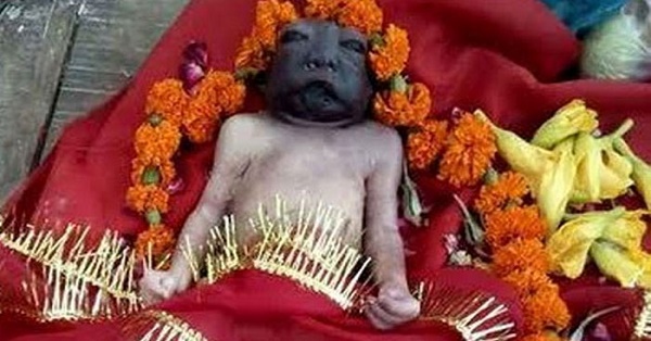 ‘Miracle’ Baby Girl With Dark Face & Fair Body Worshipped As “Maa Kali” In UP RVCJ Media