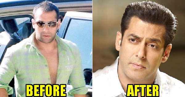 10 Bollywood Celebs Who Underwent Hair Transplant Surgery - RVCJ Media 10 Bollywood Celebs Who Underwent Hair Transplant Surgery - RVCJ Media