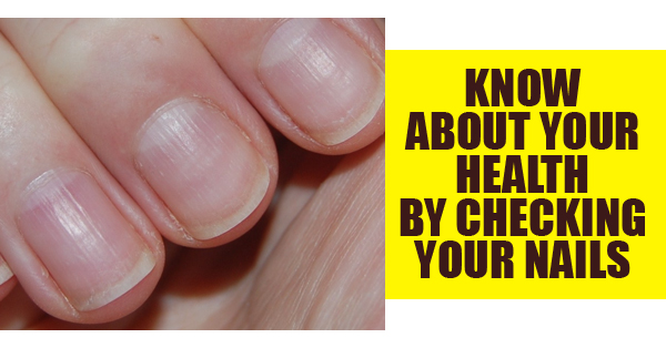 Your Nails Indicate These Things About Your Health! RVCJ Media