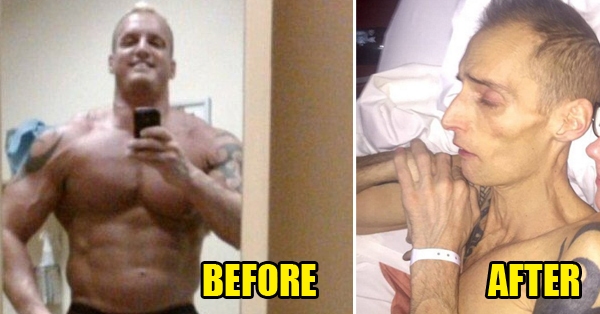 A Bodybuilder Dies From Cancer Caused By Having Excessive STEROIDS RVCJ Media