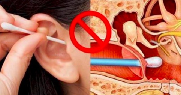 You Should Never Use Q-Tips To Clean Your Ears, Here Is WHY! RVCJ Media