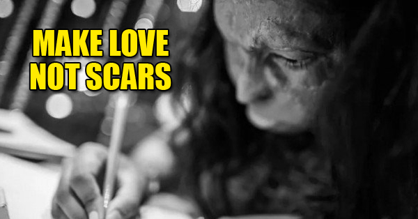 These Portraits Of Acid Survivors In India Will Fill You With Courage Right Now RVCJ Media