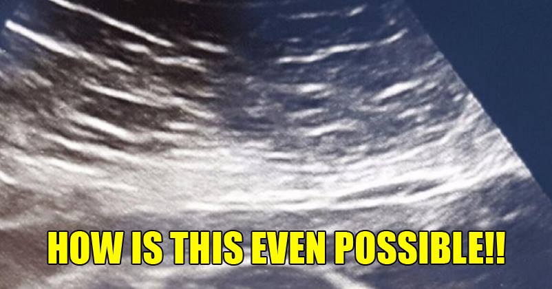 You Must Have Never Seen Such A Bizarre Ultrasound Report! It’s Getting Viral Like Crazy