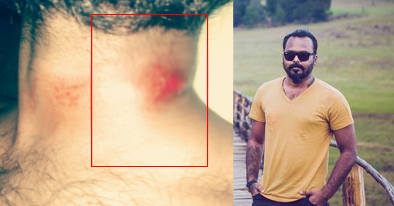 Vasanth Was Almost Strangled To Death! Inspite Of That He Saved A Girl From Getting Raped! Kudos To Him!