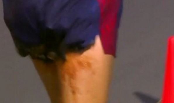 This Olympian Pooped & Started Bleeding While Racing & Still Finished at 8th Out Of 81 – RESPECT