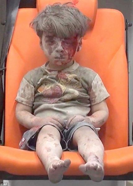bloodied syrian kid