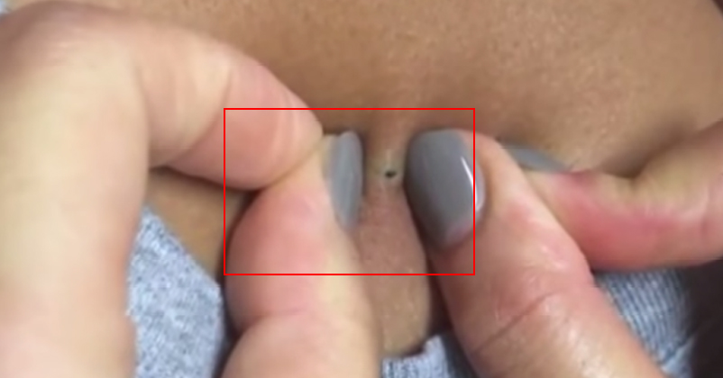 This Girl Found Something On Her Boyfriend's Neck And It Is Completely SHOCKING ! ! RVCJ Media