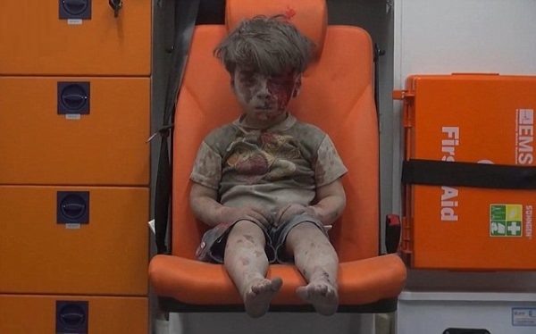 syrian kid blood 1