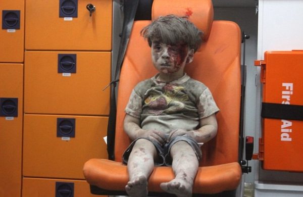 syrian kid blood 2