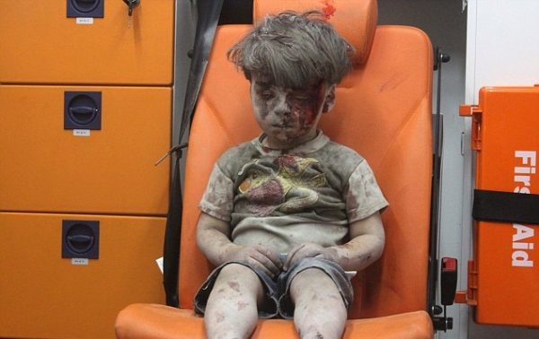 syrian kid blood
