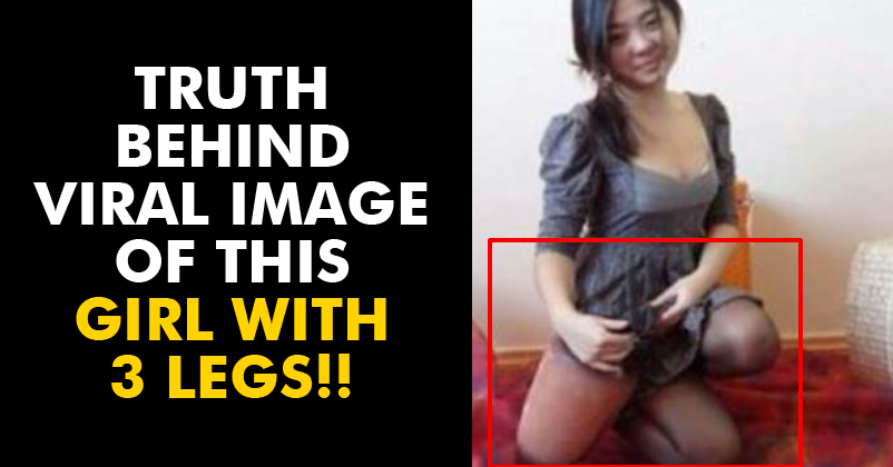 Truth Behind The Viral Pic Of This 3-Legged Girl! You'll Be Shocked! RVCJ Media