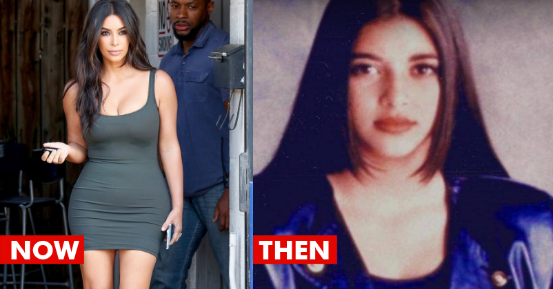 The Transformation Photos Of Kim Kardashian Before And After Surgery Are Unbelievable! RVCJ Media