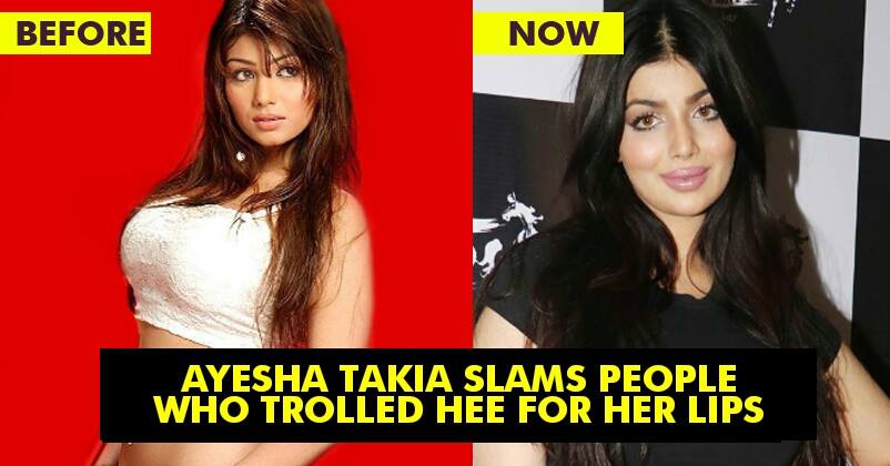 Ayesha Takia Slams People Who Trolled Her For Lip Surgery! Reveals The Truth Behind The Viral Pic! RVCJ Media
