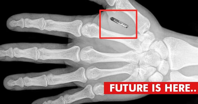 Welcome To The Future! This Company Asks Employees To Implant Microchip Inside Bodies RVCJ Media