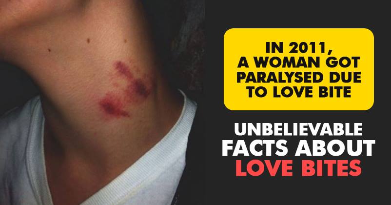 You Would Not Be Aware Of These Facts About Love Bites. Read Only If You Are 18 Yr Plus! RVCJ Media