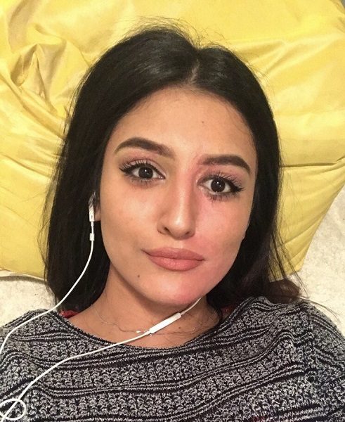 Acid Attack Survivor Shares How She Looks Like Without Makeup After Viral Post Recovery Tweet - RVCJ Media