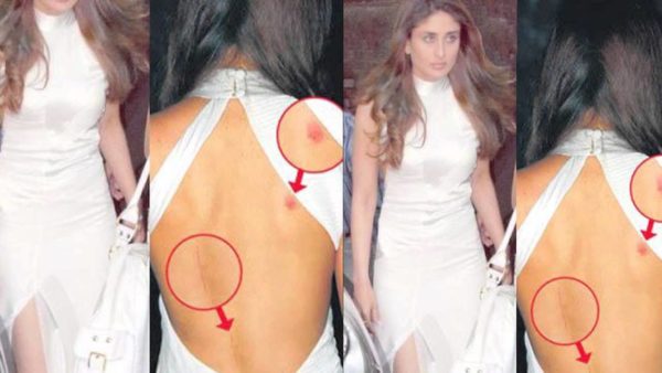 These 8 Bollywood Celebrities Were Spotted With Love Bites & Grabbed Headlines - RVCJ Media
