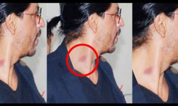 These 8 Bollywood Celebrities Were Spotted With Love Bites & Grabbed Headlines - RVCJ Media