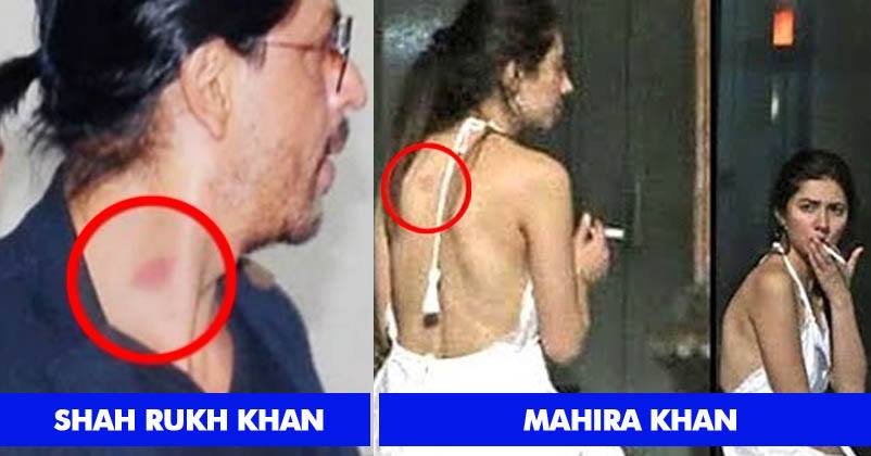 These 8 Bollywood Celebrities Were Spotted With Love Bites & Grabbed Headlines RVCJ Media