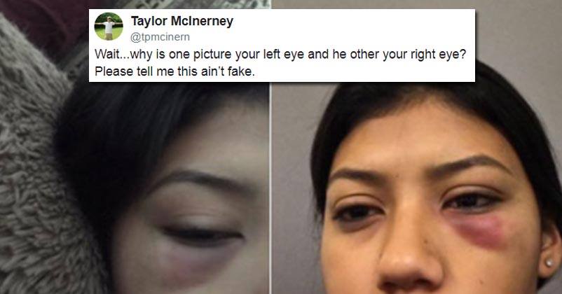 Woman Was Assaulted For Saying ‘No’ & When She Shared Her Story On Twitter, Users Called It Fake RVCJ Media
