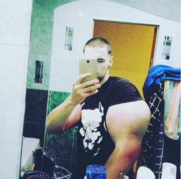 Bodybuilder Injected Oil Into His Biceps & They Got Increased By 10 Inches In Just 10 Days RVCJ Media