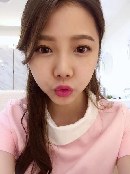 Meet Ning Chen - The Hottest Dental Nurse. Men Fake Illness Just To See The Gorgeous Girl 3 Meet Ning Chen - The Hottest Dental Nurse. Men Fake Illness Just To See The Gorgeous Girl - RVCJ Media