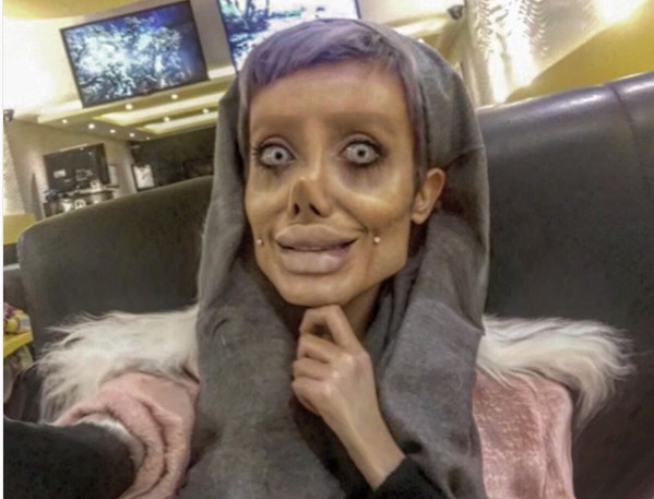 Woman Underwent 50 Surgeries To Look Like Angelina Jolie. Here’s How She Looks Like Now 4 Woman Underwent 50 Surgeries To Look Like Angelina Jolie. Here’s How She Looks Like Now - RVCJ Media