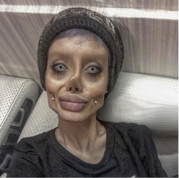 Woman Underwent 50 Surgeries To Look Like Angelina Jolie. Here’s How She Looks Like Now 12 Woman Underwent 50 Surgeries To Look Like Angelina Jolie. Here’s How She Looks Like Now - RVCJ Media