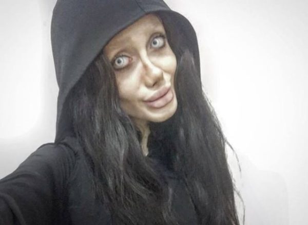 Woman Underwent 50 Surgeries To Look Like Angelina Jolie. Here’s How She Looks Like Now RVCJ Media