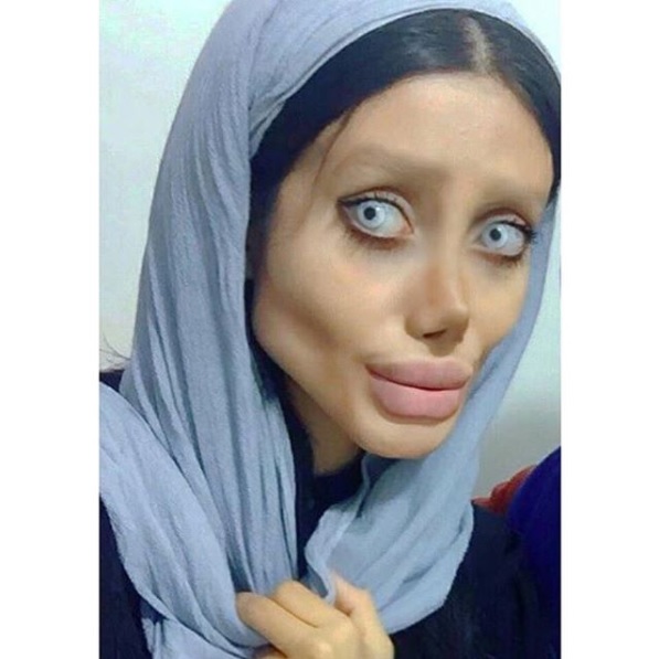 Woman Underwent 50 Surgeries To Look Like Angelina Jolie. Here’s How She Looks Like Now 9 Woman Underwent 50 Surgeries To Look Like Angelina Jolie. Here’s How She Looks Like Now - RVCJ Media