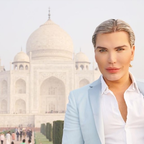 This Man Spent Over 3 Crores In 51 Plastic Surgeries & 103 Cosmetic Procedures To Look Like A Doll RVCJ Media