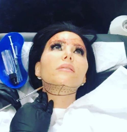 Meet The Girl Who Spent 16 Crores & Got 200 Surgeries Done. This Is How She Looks Now - RVCJ Media