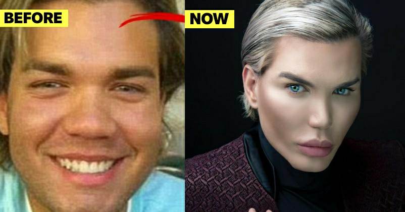 This Man Spent Over 3 Crores In 51 Plastic Surgeries & 103 Cosmetic Procedures To Look Like A Doll RVCJ Media