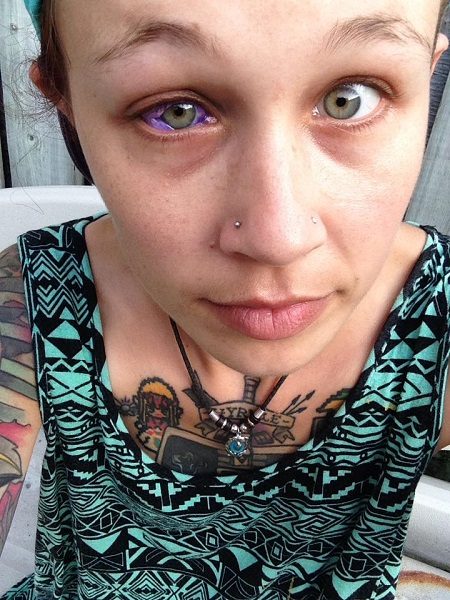 Woman Got Totally Blind From One Eye After Getting An Eye Tattoo. Her Story Will Make You Cry 4 Woman Got Totally Blind From One Eye After Getting An Eye Tattoo. Her Story Will Make You Cry - RVCJ Media