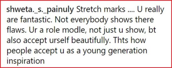 Parineeti Flaunted Her Stretch Marks &Amp; For A Change, We Saw Praises Instead Of Trolls. Way To Go 15 Parineeti Flaunted Her Stretch Marks & For A Change, We Saw Praises Instead Of Trolls. Way To Go - RVCJ Media