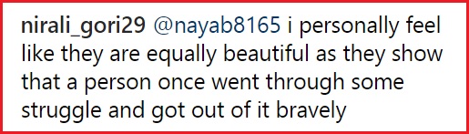 Parineeti Flaunted Her Stretch Marks &Amp; For A Change, We Saw Praises Instead Of Trolls. Way To Go 10 Parineeti Flaunted Her Stretch Marks & For A Change, We Saw Praises Instead Of Trolls. Way To Go - RVCJ Media