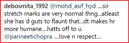 Parineeti Flaunted Her Stretch Marks &Amp; For A Change, We Saw Praises Instead Of Trolls. Way To Go 12 Parineeti Flaunted Her Stretch Marks & For A Change, We Saw Praises Instead Of Trolls. Way To Go - RVCJ Media