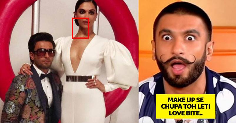 Deepika Padukone Clicked With A Mark On Her Lips At An Award Function. Is This A Love Bite? RVCJ Media