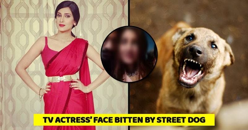 Kya Haal Mr. Panchal Actress Reena Aggarwal Got Bitten By Dog On Face During Shooting. See Pics RVCJ Media