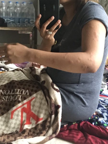 Bed Bugs Found In Air India Business Class; Passengers Posted Pics & Complained On Twitter - RVCJ Media