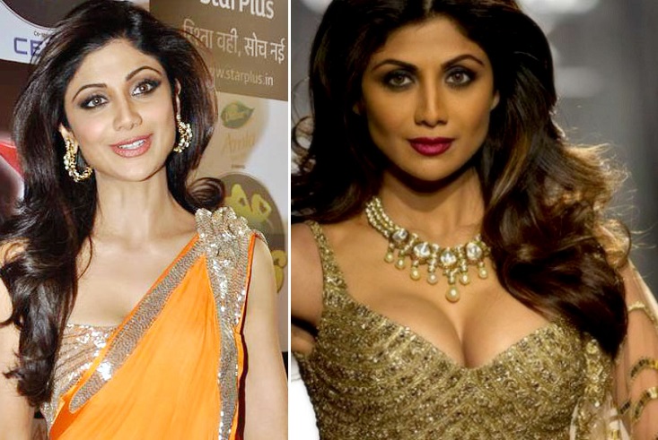 8 Bollywood Actresses Before And After Breast Implant Surgery