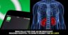 Bengaluru Man Falls For Internet Scam; Attempts To Sell His Kidney For Rs. 1.6 Crores RVCJ Media