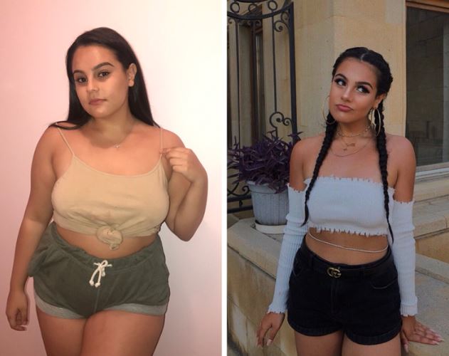 This Girl Has Lost 27 Kgs In Just 6 Months, See Her Amazing Transformation Here