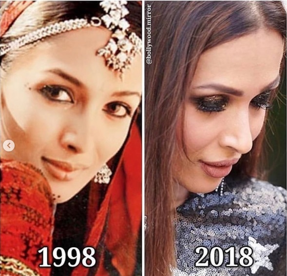 Malaika Arora Posted 20 Yrs Old Photos In #10YearChallenge, Trollers Called Her Beauty Without Brains - RVCJ Media