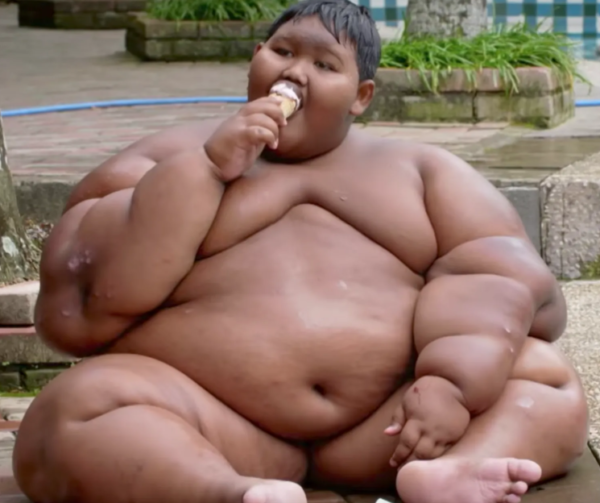 World's Heaviest Child Lost More Than 70 Kgs, This is His Story. RVCJ Media